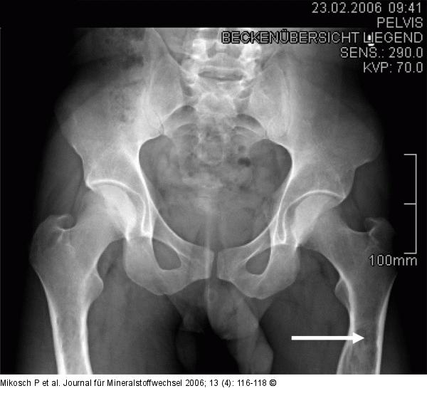 Osteologische Untersuchung