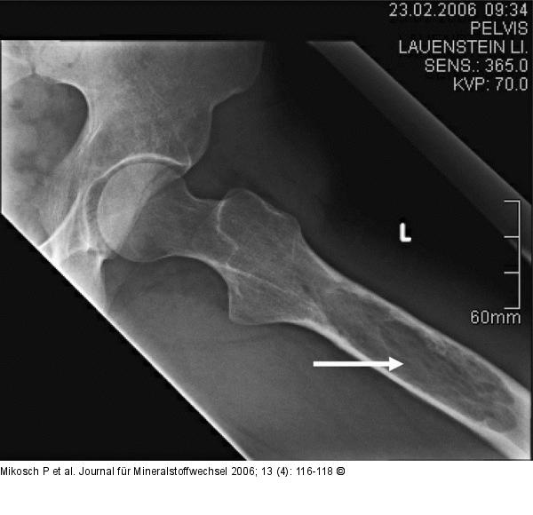 Osteologische Untersuchung