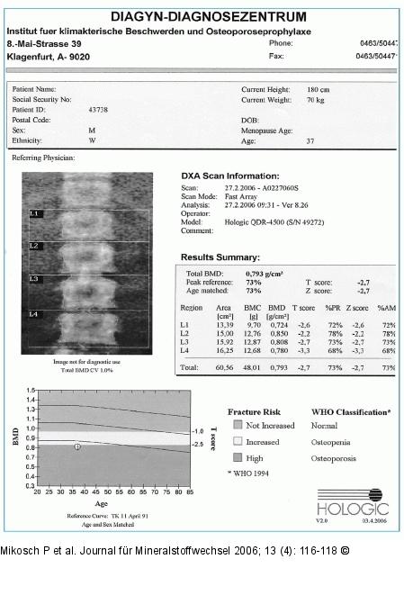 DXA-Scan -  LWS