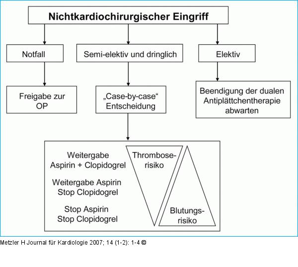 Stent - Entscheidungsbaum