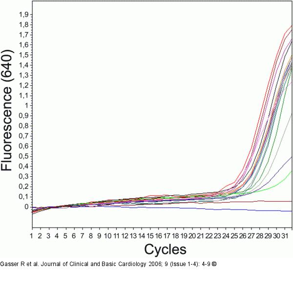 Real Time PCR