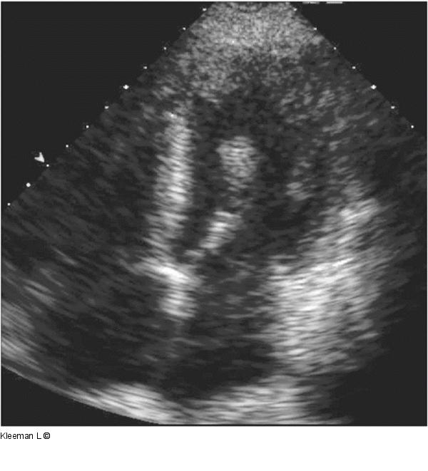 Transthorakales Echo