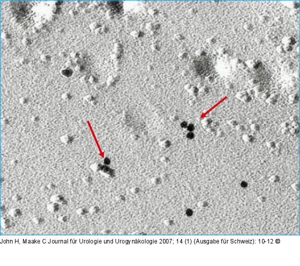 Freeze fracture immunogold labelling