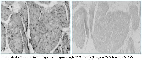 In-situ-Hybridisierung