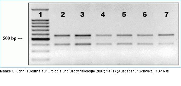 RT-PCR