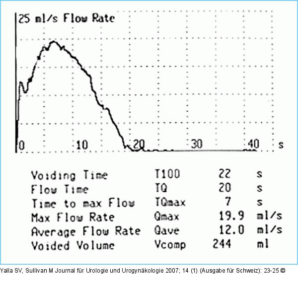 Uroflowmetry