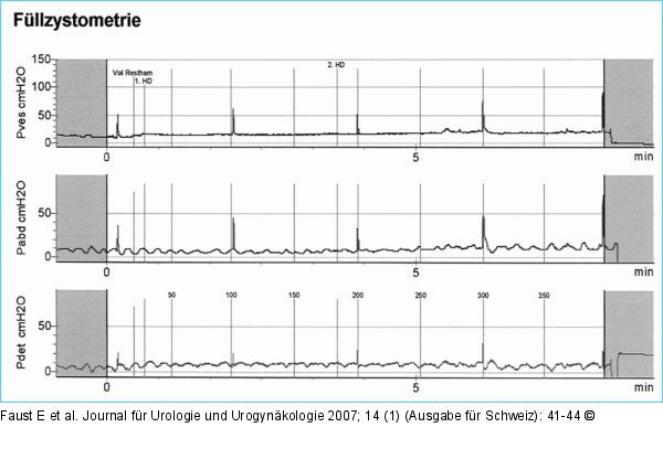 Zystometrie