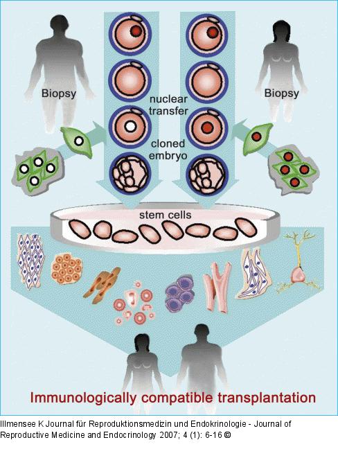 Soamtic cell nuclear transfer
