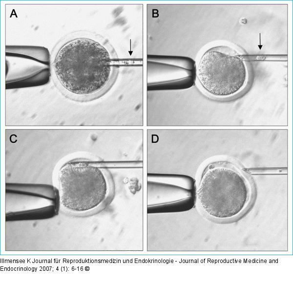 Somatic cell nuclear transfer