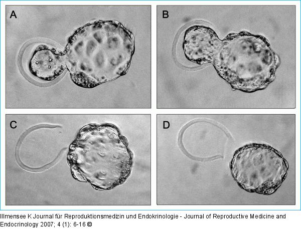 Blastocysts - Mouse embryo