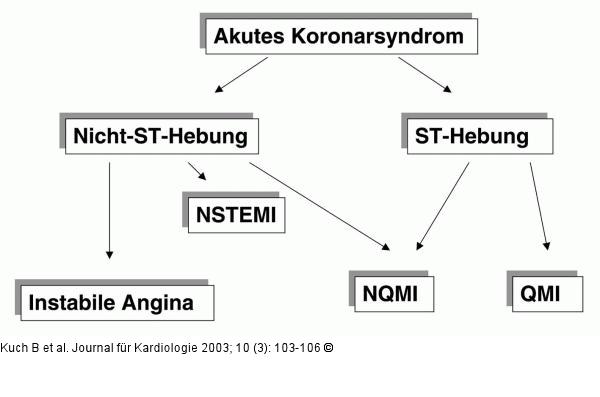 Akutes Koronarsyndrom - Einteilung