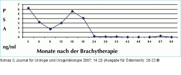 PSA-Verlauf