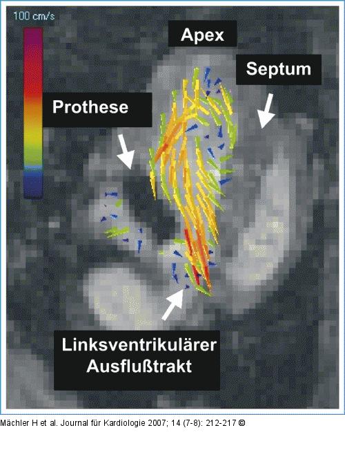Helixbildung