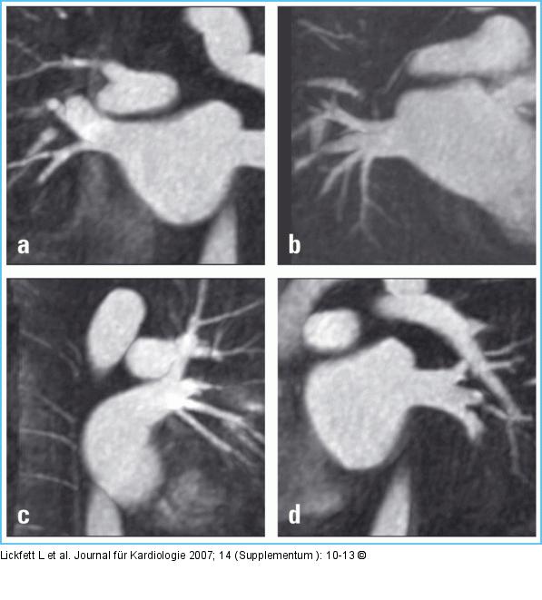 Magnetresonanzangiographie