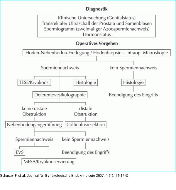 Schema zur Diagnostik und Therapie beim infertilen Mann