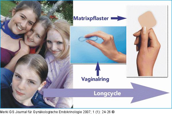 Drei Methoden moderner Antikonzeption