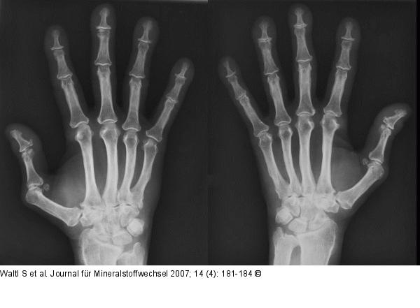 Hand