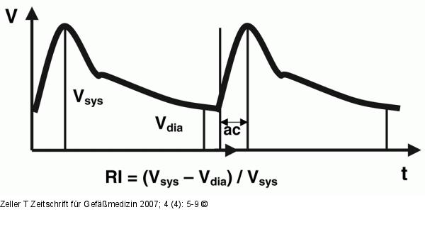 Intrarenales Doppler-Fluprofil