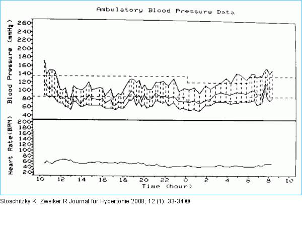 24-Stunden-Blutdruck-Monitoring