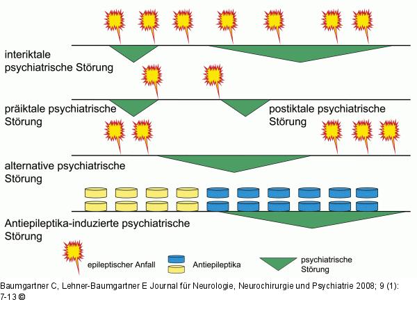 Psychiatrische Strung - Epileptischer Anfall