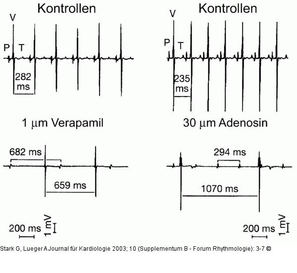 Wirkung von Adenosin