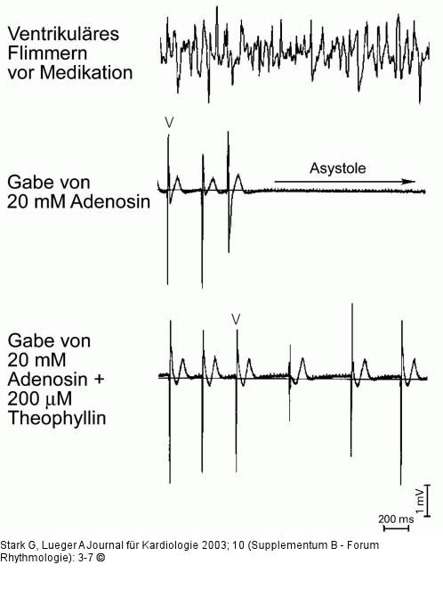 Adenosin - Theophyllin