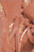 Aktuelles Bild - Abb. 6: Prothese - A. mensenterica inferior 