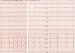 Abb. 19: AIVR