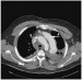 Aktuelles Bild - Abb. 3: CT-Bild