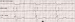 Abb. 7: Delay