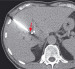 Abb. 2: Tumor