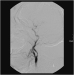Abb. 12: Angiographie