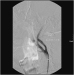 Aktuelles Bild - Abb. 13: Angiographie