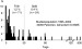 Abb. 1: BMS - Stentthrombose