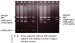 Abb. 3: AZF deletion