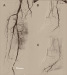 Aktuelles Bild - Abb. 2a-c: Arteria tib. posterior
