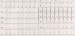 Abb. 1: EKG
