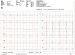 Aktuelles Bild - Abb. 1: EKG