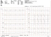 Abb. 3: EKG