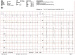 Abb. 4: EKG