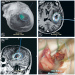 Abb. 1: Tumor