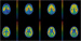 Abb. 2: Serotonin 5-HT