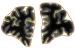 Abb. 2: GI