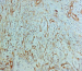 Abb. 2: Laminin
