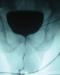 Aktuelles Bild - Abb. 2: Urethrostoma