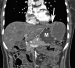 Aktuelles Bild - Abb. 1B: MDCT-Datensatz