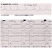 Abb. 3: EKG-Beispiel
