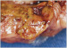 Aktuelles Bild - Abb. 2: Nebenniere