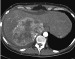 Abb. 1: CT