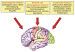 Abb. 1: Epilepsie